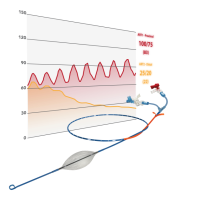 Resuscitative Endovascular Balloon Occlusion of the Aorta:  New Partial REBOA Device Allows 2+ hours of Safe Occlusion for Civilian and Military Utilization