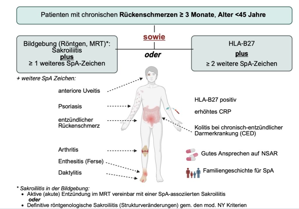 ASAS (Assessment of SpondyloArthritis international Society) - Klassifikationskrite- rien für die axiale Spondyloarthritis.