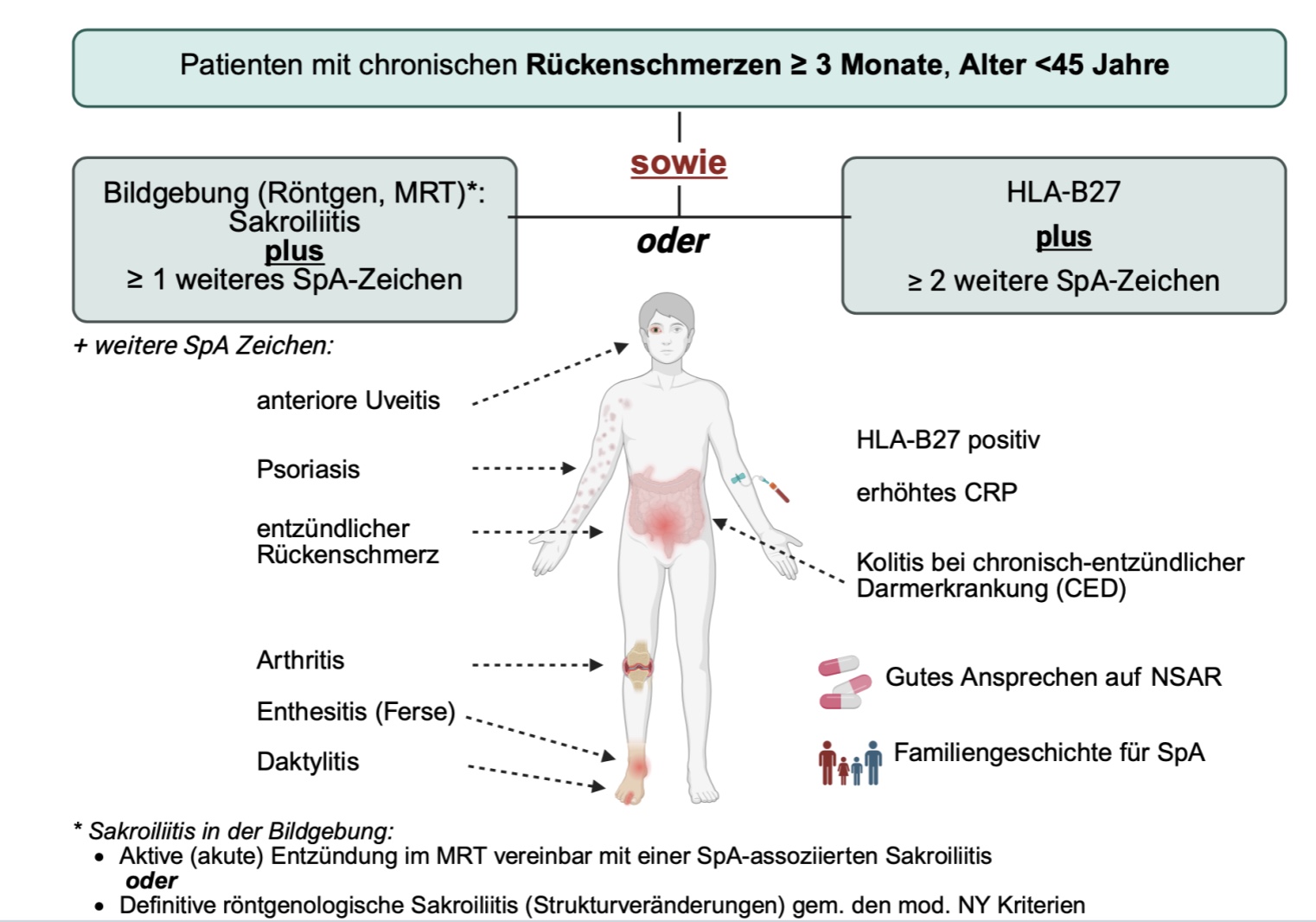 ASAS (Assessment of SpondyloArthritis international Society) - Klassifikationskrite- rien für die axiale Spondyloarthritis.