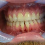 Klinische Situation präoperativ - Mögliche Therapien