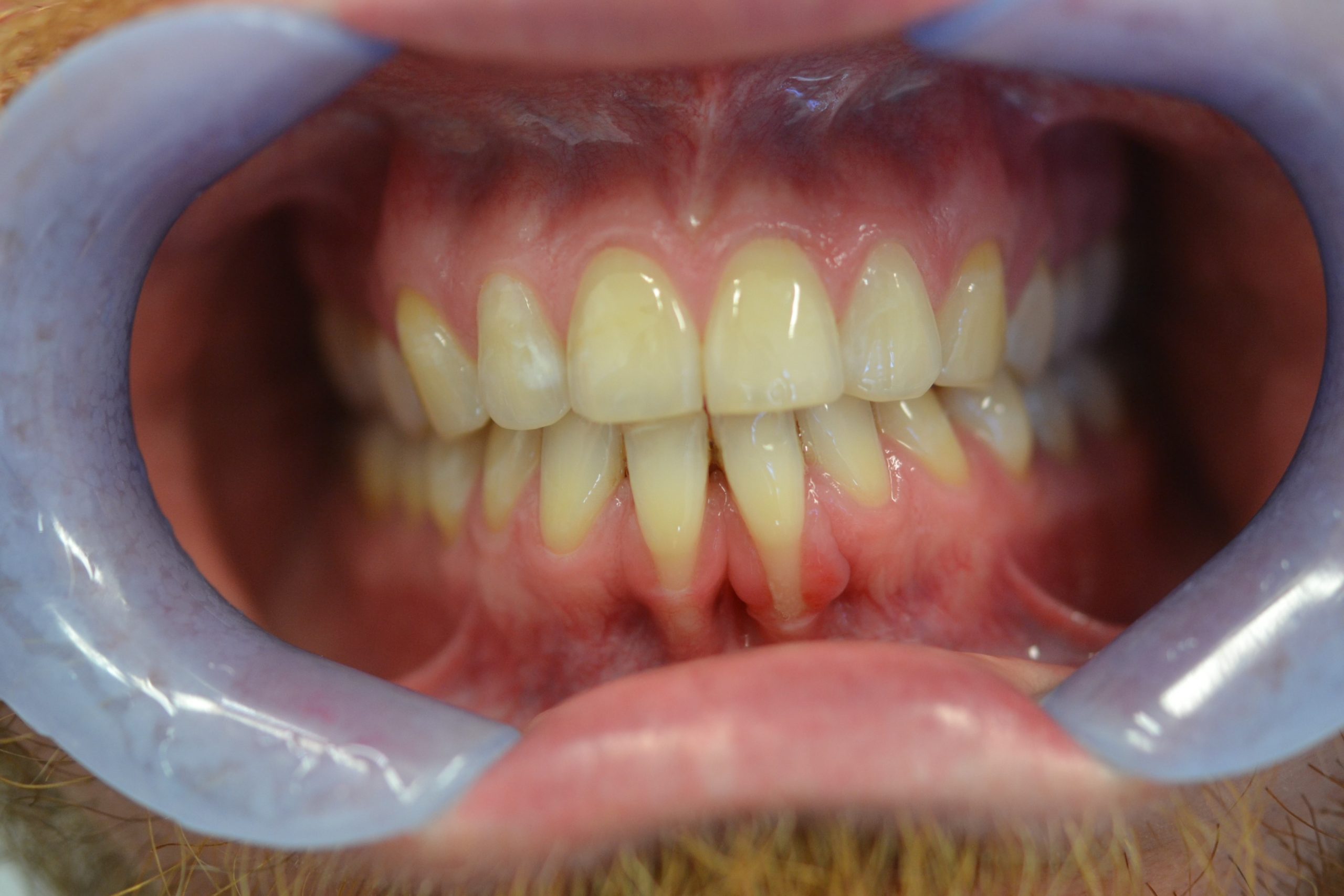 Klinische Situation präoperativ - Mögliche Therapien