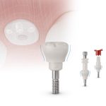 Gingividual® Concept Basic – für ein ästhetisches Ergebnis im digitalen und analogen Workflow