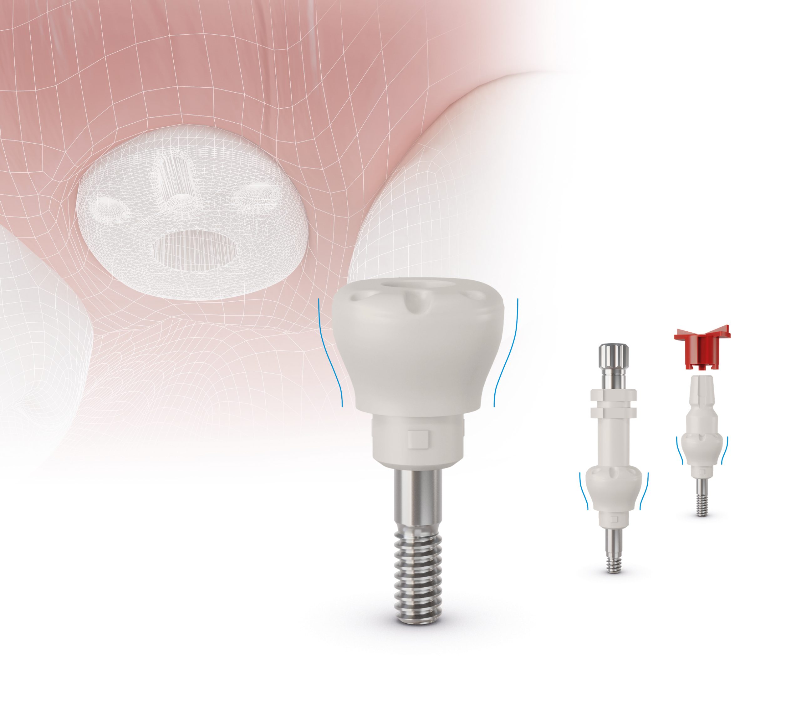Gingividual® Concept Basic – für ein ästhetisches Ergebnis im digitalen und analogen Workflow