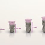 Das Helix Short von Neodent® – die Lösung bei vertikaler Knochenatrophie. Bildrechte: © Straumann Group; uneingeschränktes Nutzungsrecht in Bezug auf diese Meldung