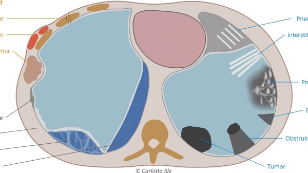 Abb. 1: Synopsis möglicher Fragestellungen in der Thoraxsonografie