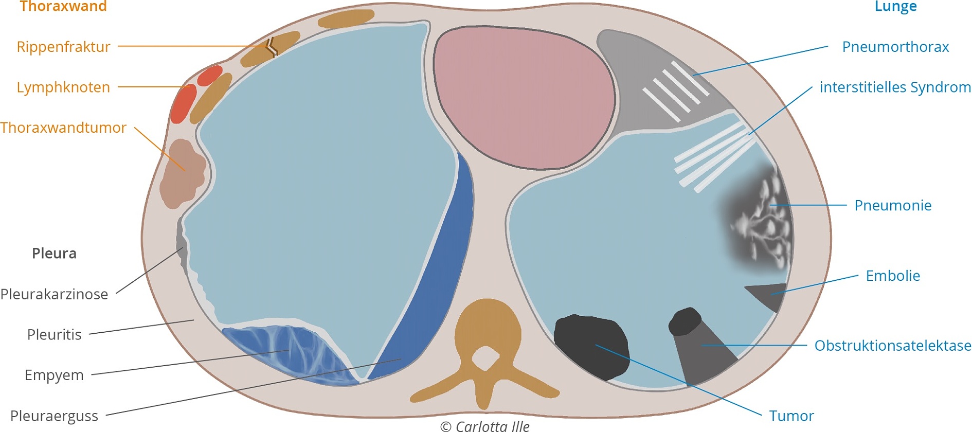 Abb. 1: Synopsis möglicher Fragestellungen in der Thoraxsonografie