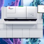 Der Access MeMed BV Assay von Beckman Coulter Diagnostics.