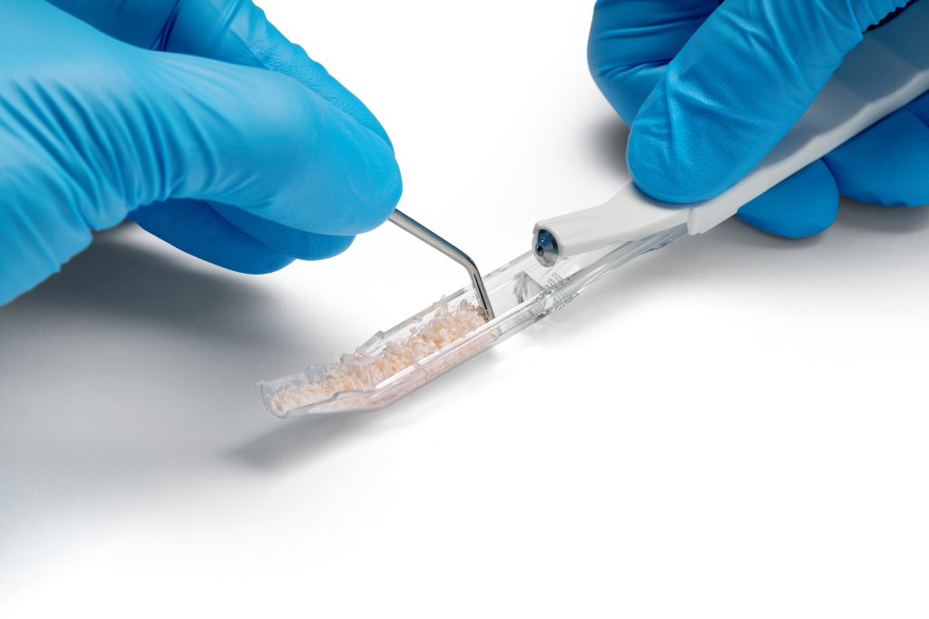 Bone Scraper: Die transparente Kammer lässt sich mit Fingerdruck nach vorne öffnen, die Knochenspäne lassen sich anschließend mit einem Instrument entnehmen.