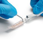 Bone Scraper: Die transparente Kammer lässt sich mit Fingerdruck nach vorne öffnen, die Knochenspäne lassen sich anschließend mit einem Instrument entnehmen.