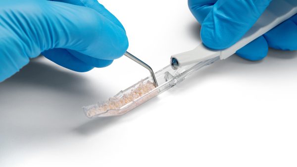 Bone Scraper: Die transparente Kammer lässt sich mit Fingerdruck nach vorne öffnen, die Knochenspäne lassen sich anschließend mit einem Instrument entnehmen.