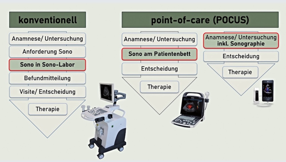 Abb. 1: Unterschied zwischen „konventioneller“ Sonografie und POCUS im klinischen Ablauf