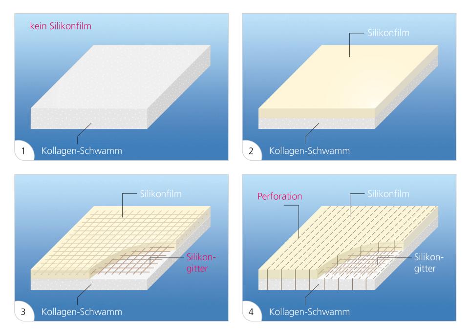 1. Einlagig; 2. Standard; 3. Verstärkt; 4. Perforiert