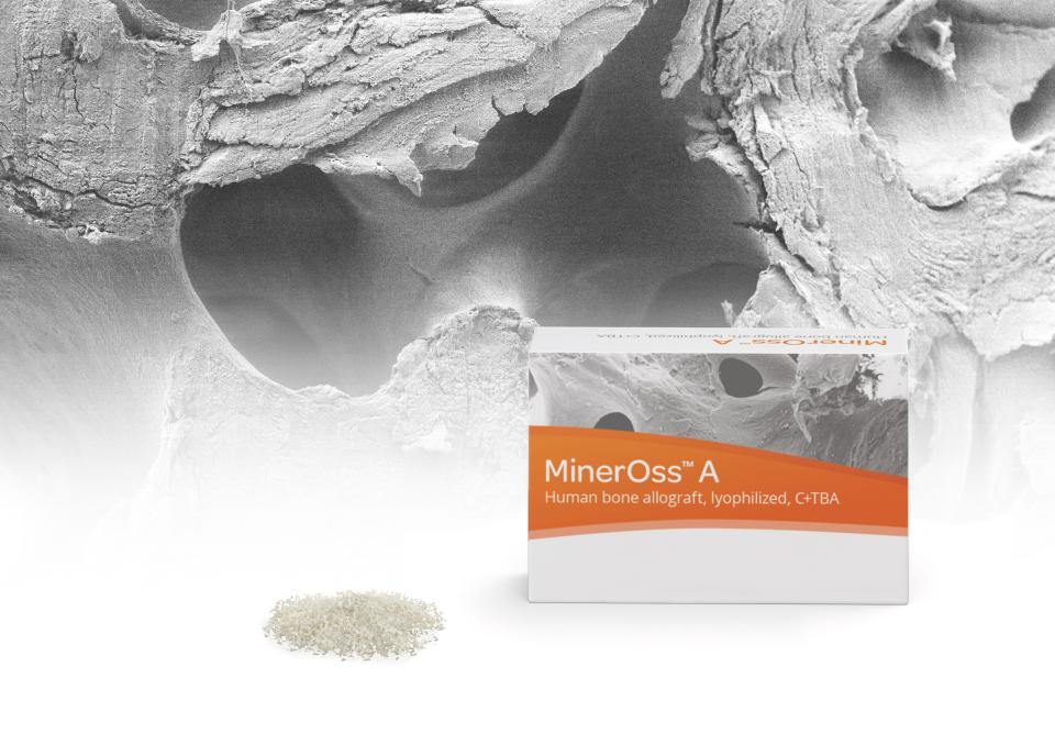 Camlog ergänzt Biomaterialportfolio um allogene Produkte