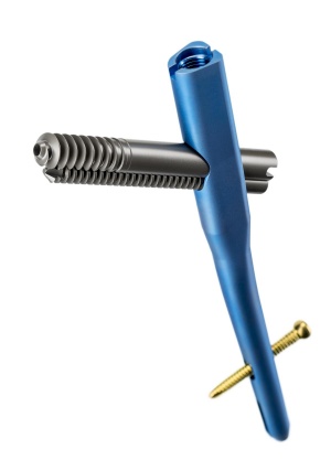 Abb. 4: TRIGEN* INTERTAN* – intertrochantärer Antegrader
Nagel.