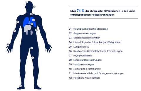 Das Hepatitis-C-Virus verursacht nicht nur Folgeerkrankungen der Lebe