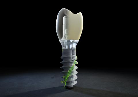 Abb. 2: Das neue TLX System ist ab September 2021 am Markt verfügbar.